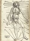 feldbuch-bloodletting-100x134